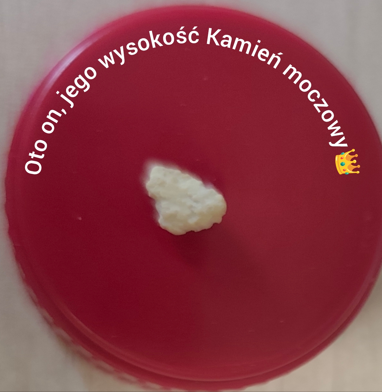 Gawęda o tym, jak kolka nerkowa stała się vis vitalis dla nauki i sztuki