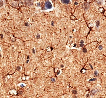 Microscopic Guardians: Neurohistology in the Service of Brain Defense and Protection