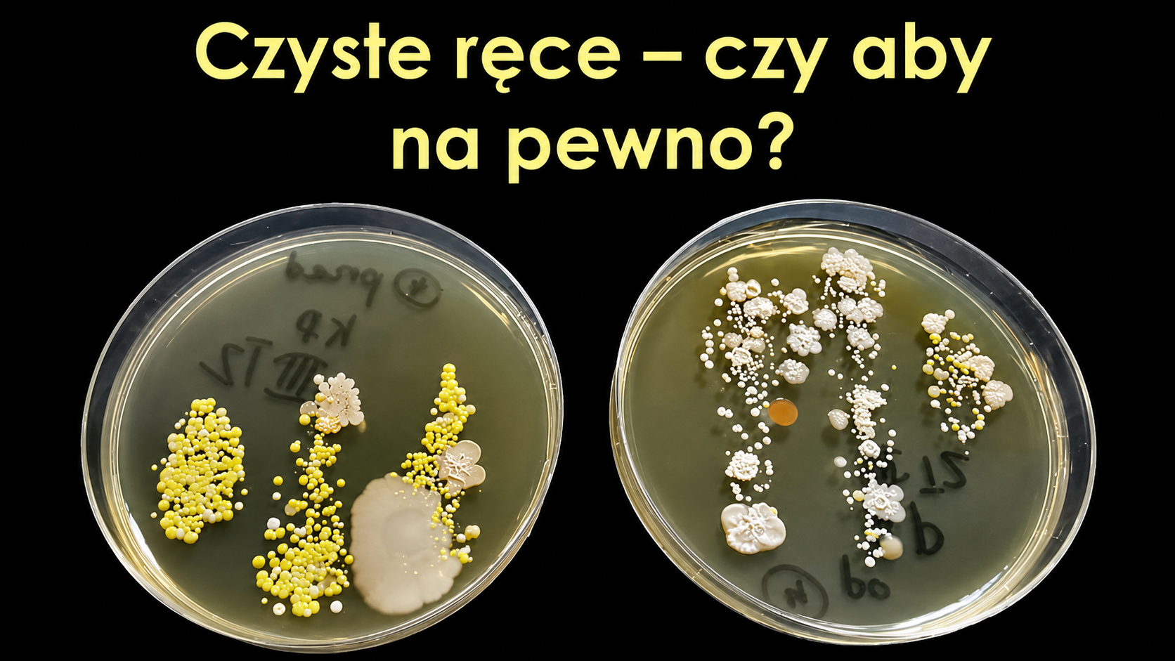 Czyste ręce - czy aby na pewno?